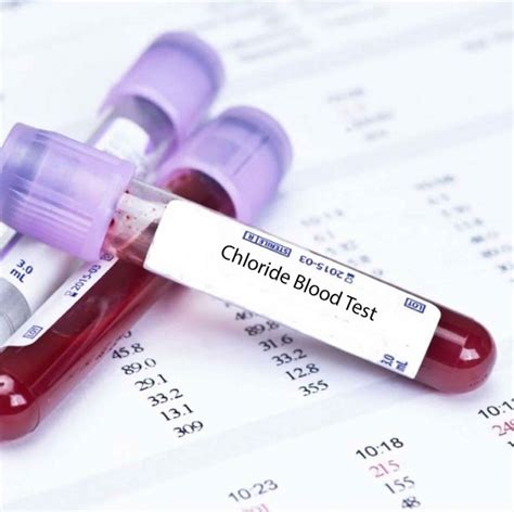 chloride levels in blood